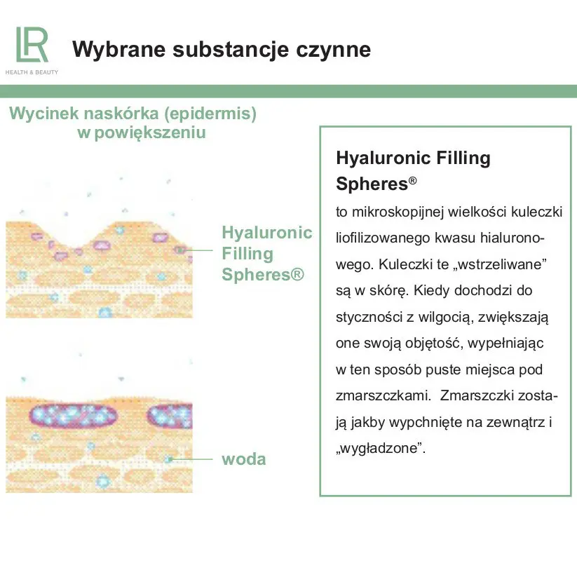 hyaluronic filling spheres